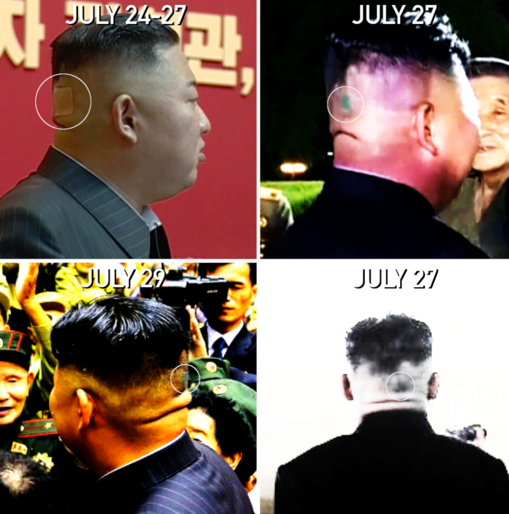 Ada Tanda Aneh Berwarna Hijau di Kepala Kim Jong-un, Apa Itu?